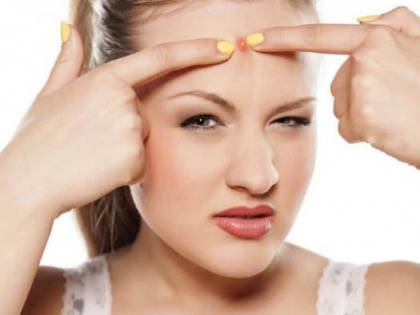 How to hide pimple with the help of makeup | मेकअप के सही इस्तेमाल से छुपाएं पिंपल्स, जानें 5 आसान स्टेप्स
