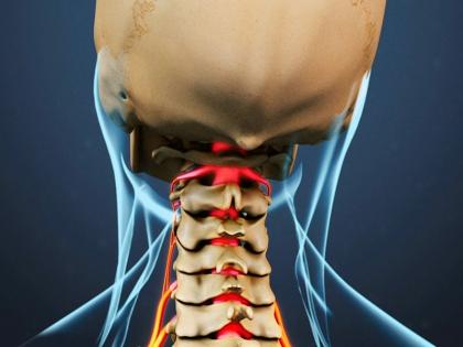 home treatment for pinched nerve in neck: best and effective home remedies to treat pinched nerve | गर्दन की नस दबने का इलाज : गर्दन की जकड़न, नस पे नस चढ़ने के लिए आजमाएं ये 5 घरेलू उपचार home treatment for pinched nerve in neck: best and effective home remedies to treat pinched nerve | गर्दन की नस दबने का इलाज : गर्दन की जकड़न, नस पे नस चढ़ने के लिए आजमाएं ये 5 घरेलू उपचार