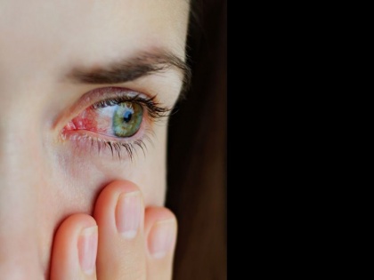 home remedies for eyes pain, redness, infection, watering, burning and puffiness, Pink Eye or conjunctivitis in Hindi | आंखों का लाल होना, पानी आना, खुजली, धुंधलापन, इन्फेक्शन को एक रात में खत्म कर सकती हैं ये 3 चीजें