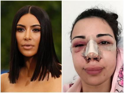 america women spend 3 crore rupees on cosmetic surgeries to look like Hollywood star kim kardashian | हॉलीवुड स्टार की तरह दिखने की चाहत में महिला ने खर्च कर डाले करोड़ों लेकिन शरीर का हो गया ऐसा हाल
