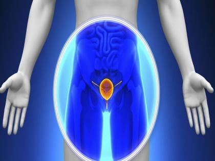 early signs and symptoms of prostate cancer, what is prostate and their work in body, prostate cancer medical treatment and causes | प्रोस्टेट कैंसर से पहले शरीर देता है 10 चेतावनी, जरूर कराएं ये मेडिकल टेस्ट, टल सकती है मुसीबत