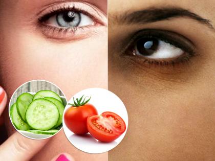 home remedies to get rid of puffy eyes dark circles | पफी आइज और डार्क सर्कल से छुटकारा दिलाएंगी किचन में मौजूद ये 5 चीजें