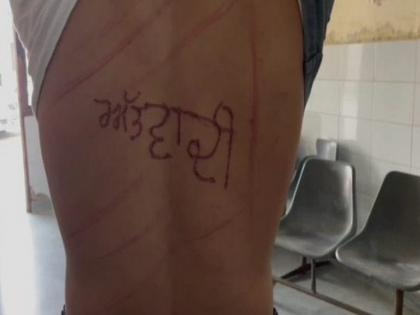 Punjab prisoner alleges terrorist written on his back and was tortured, probe rdered | 'पीटा, फिर पीठ पर लिख दिया आतंकवादी', पंजाब में जेल में बंद कैदी ने लगाया आरोप, जांच के आदेश