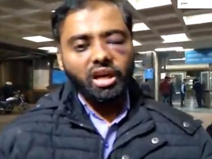 CAA: Rajdeep Sardesai tweets Jamia Student Video who lost his eye by Police thrashing, trolled | CAA: राजदीप सरदेसाई ने पुलिस की लाठी से आंख खोने वाले जामिया के छात्र का वीडियो किया ट्वीट, यूजर बोला- पैसे लेते हो या फ्री सर्विस देते हो CAA: Rajdeep Sardesai tweets Jamia Student Video who lost his eye by Police thrashing, trolled | CAA: राजदीप सरदेसाई ने पुलिस की लाठी से आंख खोने वाले जामिया के छात्र का वीडियो किया ट्वीट, यूजर बोला- पैसे लेते हो या फ्री सर्विस देते हो