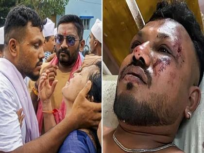 Ahmedabad Crash’s Lone Survivor Struggles With Trauma After Losing Brother | 'कुछ नहीं बोलता, आधी रात को जागता है': अहमदाबाद दुर्घटना में जीवित बचे एकमात्र व्यक्ति भाई को खोने के बाद अभी भी सदमे से त्रस्त