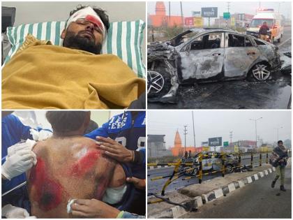 Rishabh Pant Accident Pant came out of the burning car by breaking window had a nap while driving | Rishabh Pant Accident: जलती कार से खिड़की तोड़ बाहर निकले ऋषभ पंत, गाड़ी चलाते वक्त आ गई थी झपकी, कहा... Rishabh Pant Accident Pant came out of the burning car by breaking window had a nap while driving | Rishabh Pant Accident: जलती कार से खिड़की तोड़ बाहर निकले ऋषभ पंत, गाड़ी चलाते वक्त आ गई थी झपकी, कहा...