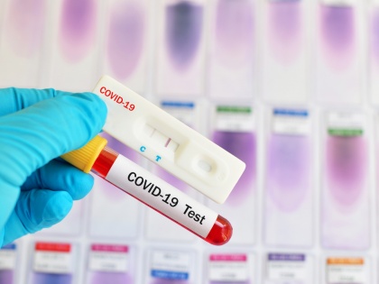 covid-19 corona rt pcr test cost in delhi reduced from rs 2400 to rs 800 government  | कोविड-19ः दिल्ली सरकार ने घटाई RT-PCR टेस्ट की फीस, 2400 नहीं बल्कि 800 रुपये में जांच