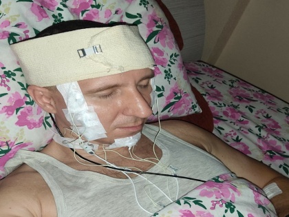 russian man Michael Raduga try to control dream do surgery to put chip in mind | रूस: सपनों को काबू करने के लिए दिमाग में डालना चाहता था चिप, सर्जरी के लिए ड्रील मशीन से खोपड़ी में किया छेद और फिर.....जानें पूरा मामला