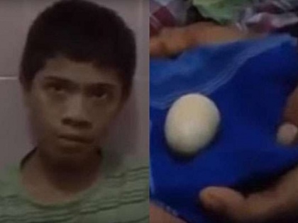 this 14 year old boy claims he laid 20 eggs in front of doctors from last two year in Indonesia | दुनिया का सबसे अजीबोगरीब मामला, पिछले 2 साल से अंडे दे रहा है ये लड़का, विज्ञान भी हैरान
