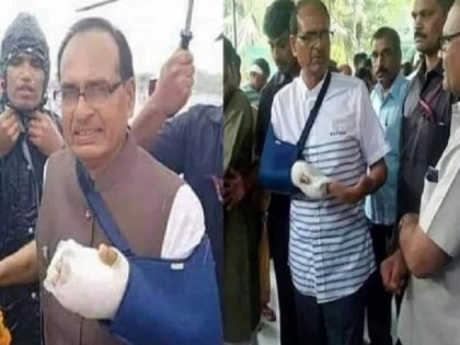 Is Shivraj Singh Chouhan faking his hand fracture, social media claim here is truth | क्या शिवराज सिंह चौहान हाथ में फ्रैक्चर का नाटक कर रहे हैं या सच में टूट गया? 