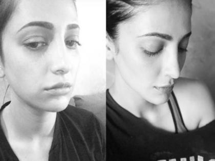 shruti haasan slams body shaming ive had plastic surgery | बॉडी शेमिंग पर खुलकर बोलीं श्रुति हासन, कहा-'हां मैंने प्लास्टिक सर्जरी करवाई और मैं इसके लिए शर्मिंदा नहीं हूं' shruti haasan slams body shaming ive had plastic surgery | बॉडी शेमिंग पर खुलकर बोलीं श्रुति हासन, कहा-'हां मैंने प्लास्टिक सर्जरी करवाई और मैं इसके लिए शर्मिंदा नहीं हूं'