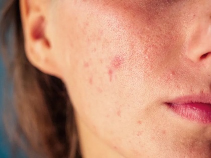 how to make skin bright and glowing: 6 Morning Habits That Can Damage Your Skin | त्वचा को सुंदर कैसे बनाएं : त्वचा को समय से पहले बूढ़ा कर देती हैं सुबह की ये 6 गंदी आदतें
