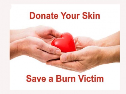 Hospital donated skin to acid attack victim, know how skin taken from dead donor removes the scars of others | एसिड अटैक पीड़िता को अस्पताल ने दान में दी स्किन, जानिए कैसे डेड डोनर से लिया गया स्किन दूसरों के दाग को मिटाता है