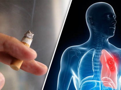 smoking effects on lungs Lung disease is increasing due to smoke even non-smokers are becoming victims Know what experts say | धूम्रपान के धुएं से बढ़ रही फेफड़ों की बीमारी, सिगरेट न पीने वाले भी हो रहे शिकार; जानें क्या कहते हैं एक्सपर्ट