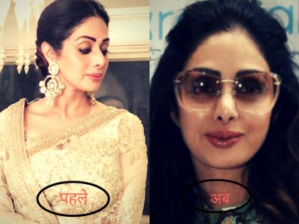 Has Sridevi got lip work done at the age of 54? | 54 साल की उम्र में श्रीदेवी ने क्या सच में कराई लिप सर्जरी?