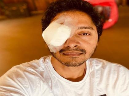 Shreyas Talpade injures his eye during lockdown gives an update on his condition | एक आंख पर पट्टी बांध श्रेयस तलपड़े ने फैंस से पूछा सवाल, क्या आप बता सकते हैं, क्या हुआ होगा?