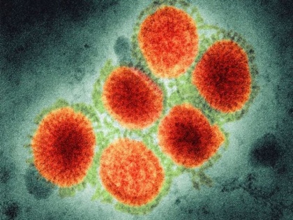 Supreme Court 6 judges are down with H1N1 virus, know signs and symptoms and prevention tips of swine flu | सुप्रीम कोर्ट के 6 जज खतरनाक वायरस की चपेट में, जानिये इस वायरस के कारण, लक्षण और बचाव