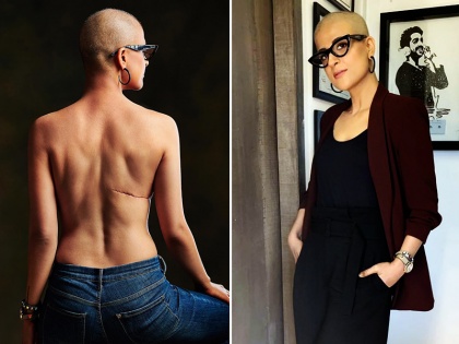 world cancer day special : ayushmann khurrana wife tahira kashyap shared bald hair pics on social media suffering from breast cancer | दिल को अंदर तक झकझोर देगी ताहिरा कश्यप की ये फोटो, ऐसे जीती कैंसर की जंग