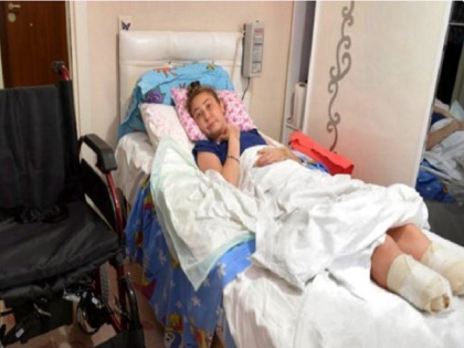 25 yr old women loses her legs after undergoing nose job | इस महिला को नाक की सर्जरी कराना पड़ा महंगा, जान बचाने के लिए काटने पड़ें दोनों पैर