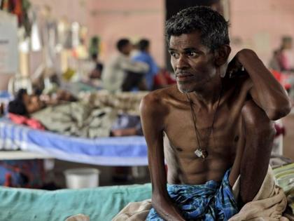Tuberculosis or TB in India : symptoms, causes and daily death due to TB in india | भारत में टीबी रोग की स्थिति : कई डॉक्टर नहीं जानते इसके लक्षण, रोजाना 1,400 टीबी मरीजों की मौत