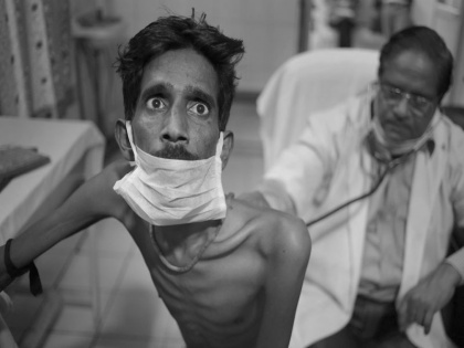 india-tops-world-in-unreported-tuberculosis-cases | कोरोना के दौरान भारत में टीबी के मामले में आई भारी कमी, WHO ने कहा- इंडिया ने दर्ज नहीं किए केस