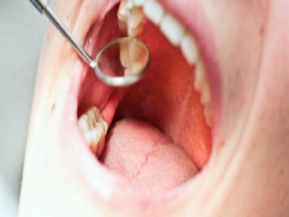 BHU Expert claimes now 32 teeth are not coming to new generation, wisdom teeth also missing | नई पीढ़ी को नहीं आ रहे अब 32 दांत, अकल दाढ़ भी गायब! बीएचयू के विशेषज्ञ का दावा