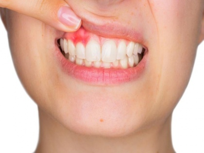 Dental care tips : causes of teeth related problems and home remedies, prevention tips and food list for toothache | सावधान! दांत-मसूड़ों की सड़न का यह अजीब कारण कर देगा हैरान, 6 चीजें बनाएंगी मजबूत
