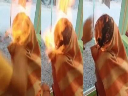 terrible fire broke out head boy fire hair cut young man badly burnt accident gujarat vapi viral video | वीडियो: 'फायर हेयर कट' करवाने गए लड़के के सिर में लगी भयानक आग, हादसे में बुरी तरह झुलसे युवक के बाल