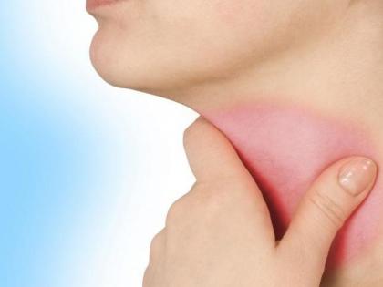Do not ignore sore throat long time know cause treatment health tips in hindi | लंबे समय से गले में खराश को मत कीजिए नजरअंदाज, वरना पड़ सकता है आपको भारी, जानिए Sore Throat के कारण-इलाज