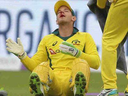 Australia captain Tim Paine received stitches after being hit in the face by a ball vs England | टिम पेन के चेहरे पर लगी गेंद, निकलने लगा खून और लगे टांके, फिर भी नहीं गए मैदान से बाहर