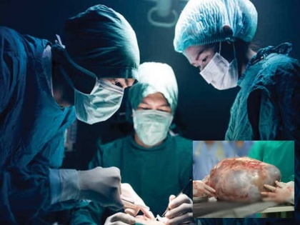 Patna 15 kg tumor removed from woman's stomach in a hospital | पटना के एक सरकारी अस्पताल में महिला के पेट से निकाला गया 15 किलो का ट्यूमर, सर्जरी करने वालीं डॉक्टर ने कही ये बात