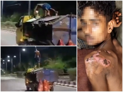 up police gomtinagar youth show stunt push up moving garbage vehicle fall meet accident viral video shaktiman | वीडियो: शक्तिमान नहीं, बुद्धिमान बनें- चलती गाड़ी पर युवक कर रहा था खतरनाक स्टंट, अचानक फिसला पैर और फिर हुआ बड़ा हादसा