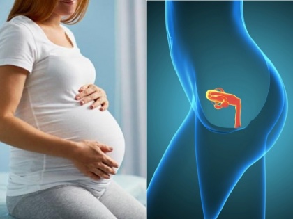 Uterus Why have uterine diseases increased? Know what experts say | Uterus: गर्भाशय की बीमारियां क्यों बढ़ गई हैं?, जानें क्या कहते हैं विशेषज्ञ