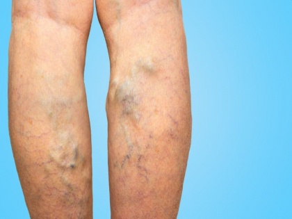 Health tips : list of diseases you can find in just 5 seconds after see your legs | अंदर ही अंदर आपको हो रही हैं 9 खतरनाक बीमारियां, पैरों को देखकर 5 सेकंड में ऐसे जानें
