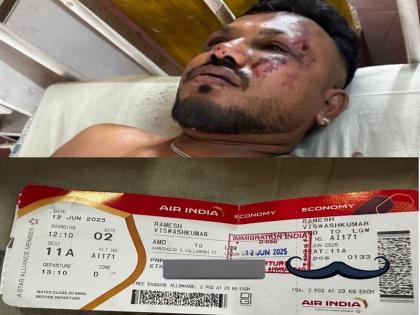 Ahmedabad Plane Crash: Vishwash Kumar, who was sitting on seat 11A, told the story of his miraculous survival from the accident | Ahmedabad Plane Crash: सीट 11ए पर बैठे विश्वाशकुमार ने दुर्घटना से चमत्कारिक रूप से बचने की कहानी सुनाई | VIDEO Ahmedabad Plane Crash: Vishwash Kumar, who was sitting on seat 11A, told the story of his miraculous survival from the accident | Ahmedabad Plane Crash: सीट 11ए पर बैठे विश्वाशकुमार ने दुर्घटना से चमत्कारिक रूप से बचने की कहानी सुनाई | VIDEO