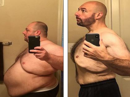 weight loss tips how to lose weight fast with exercise and diet | 184 किलो वजन के साथ नहीं बना पा रहा था सेक्स संबंध, पत्नी ने दिया तलाक, 1 साल में घटाया 101 किलो weight loss tips how to lose weight fast with exercise and diet | 184 किलो वजन के साथ नहीं बना पा रहा था सेक्स संबंध, पत्नी ने दिया तलाक, 1 साल में घटाया 101 किलो