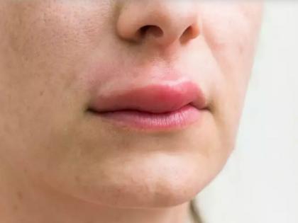 White Fungus symptoms in Hindi: different between White Fungus and black Fungus symptoms, causes and medical treatment of White Fungus in Hindi | White Fungus symptoms: 'ब्लैक फंगस' से ज्यादा घातक है 'व्हाइट फंगस', दोनों के लक्षणों में हैं ये 5 अंतर White Fungus symptoms in Hindi: different between White Fungus and black Fungus symptoms, causes and medical treatment of White Fungus in Hindi | White Fungus symptoms: 'ब्लैक फंगस' से ज्यादा घातक है 'व्हाइट फंगस', दोनों के लक्षणों में हैं ये 5 अंतर