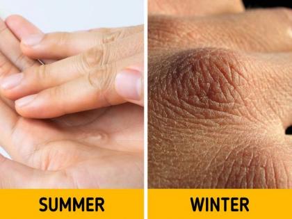 winter health tips: common winter diseases and their treatment and home remedies in Hindi | Winter tips: सर्दियों की ये 7 गलतियां आपके शरीर को बना सकती है 7 बीमारियों का अड्डा