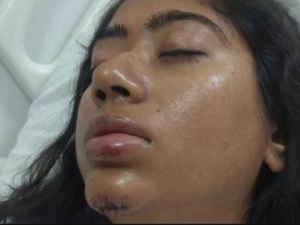 Woman journalist dragged out of moving auto by snatchers, suffers injuries | दिल्ली में सरेआम महिला पत्रकार पर जानलेवा हमला, चलती ऑटो से बाइक सवारों ने दिया धक्का, बाल बाल बची जान