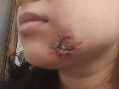 Noida Dog bites woman face owner says go to police do whatever you can | नोएडा: पालतू कुत्ते ने महिला को बनाया शिकार, मालिक ने धमकी देते हुए कहा, "पुलिस के पास जाओ, जो कर सकती है कर लो"