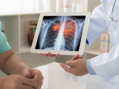 chest x-ray can tell patient is covid positive or not kgmu develops artificial intelligence porgramme | सीने का X-Ray बताएगा मरीज कोरोना पॉजिटिव है या नहीं,  KGMU को मिली बड़ी कामयाबी