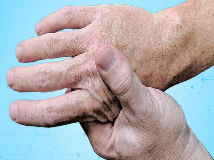 Joint Pain Home Remedies Get Rid Joint Pain जोड़ों का दर्द होगा