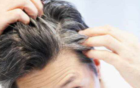 Home Remedies White Hair Treatment Safed balo ka ilaj | सफेद बालों का इलाज  : अपनाएं ये 6 घरेलू उपाय, सफेद बालों से मिलेगा छुटकारा | Lokmat News Hindi